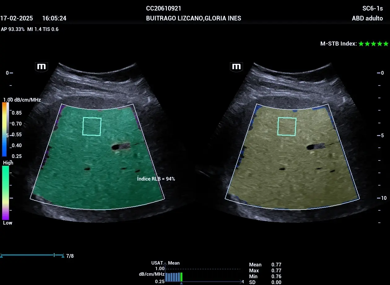 Enfermedades que se pueden detectar con una ecografía abdominal