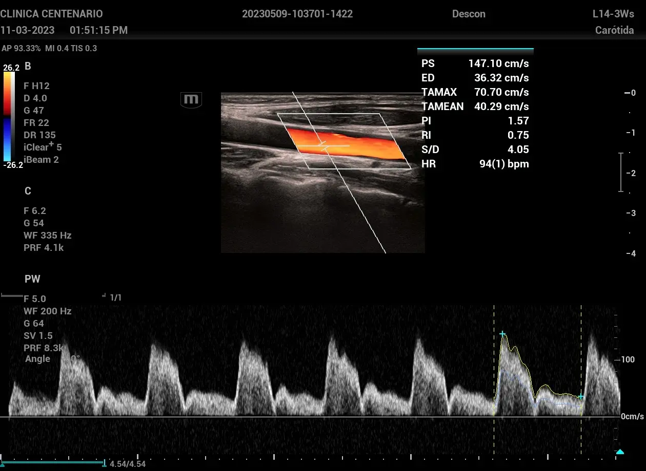 ¿Cuándo está indicado este tipo de estudio?
