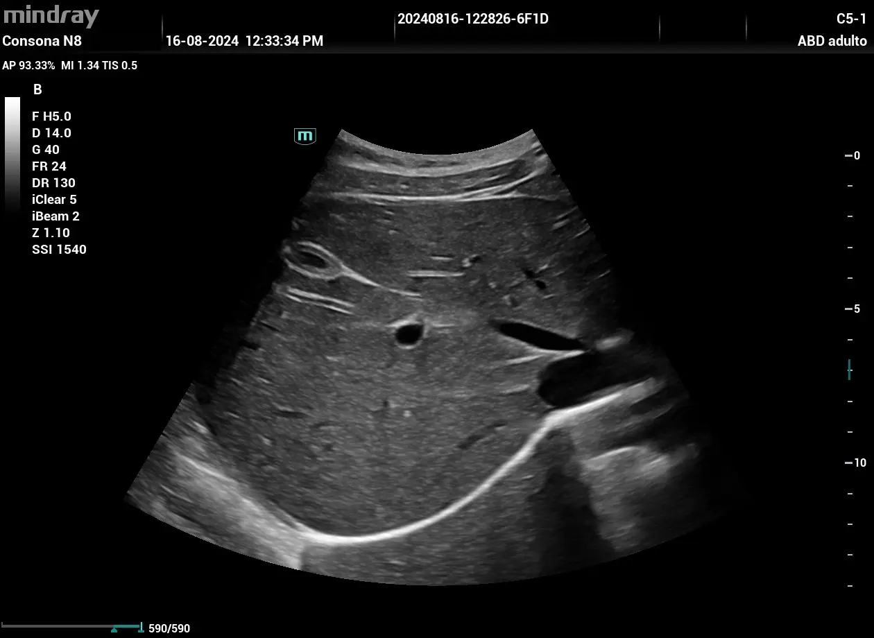 Patologías del hígado y la vesícula biliar