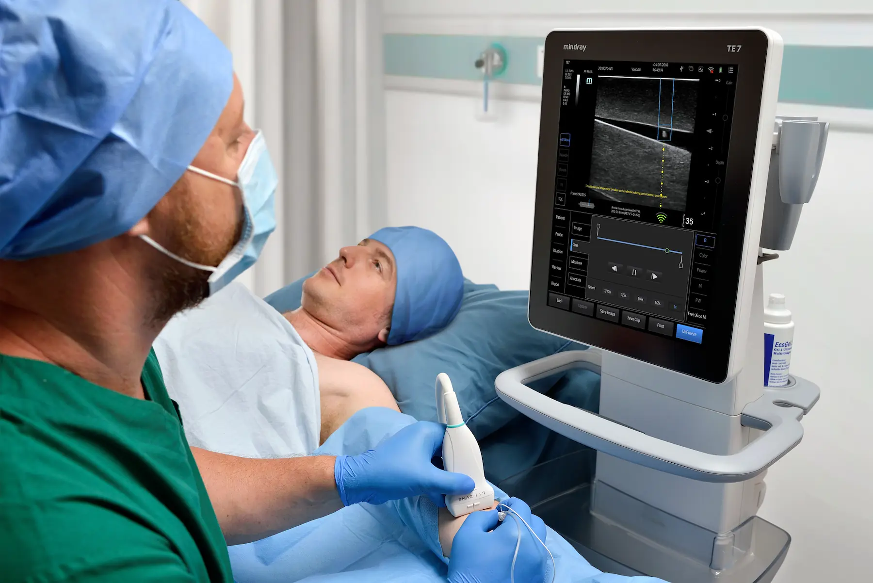 Claves para elegir un ecógrafo según las necesidades de su especialidad médica