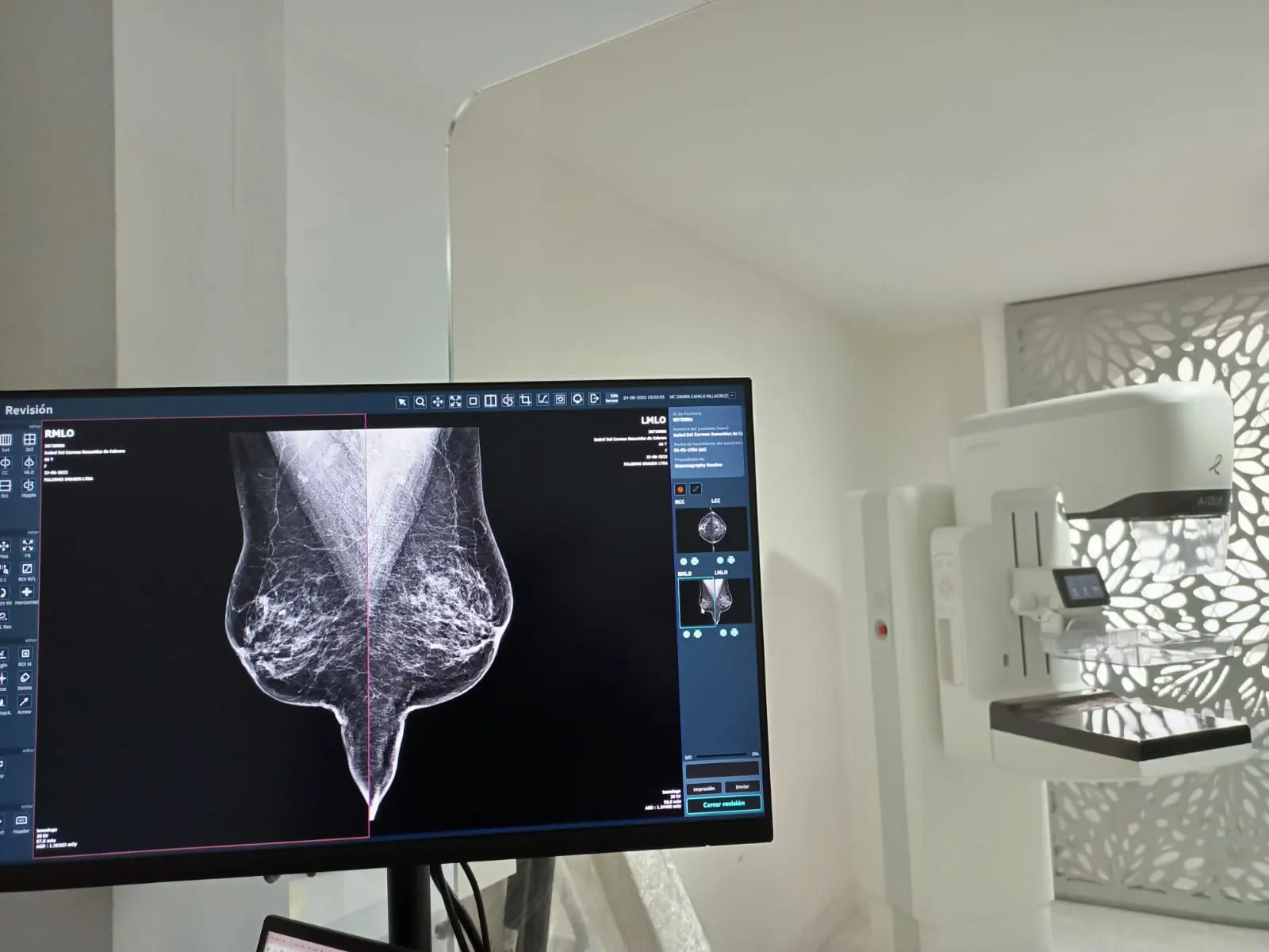 Estación de revisión y protocolo de flujo de trabajo avanzado