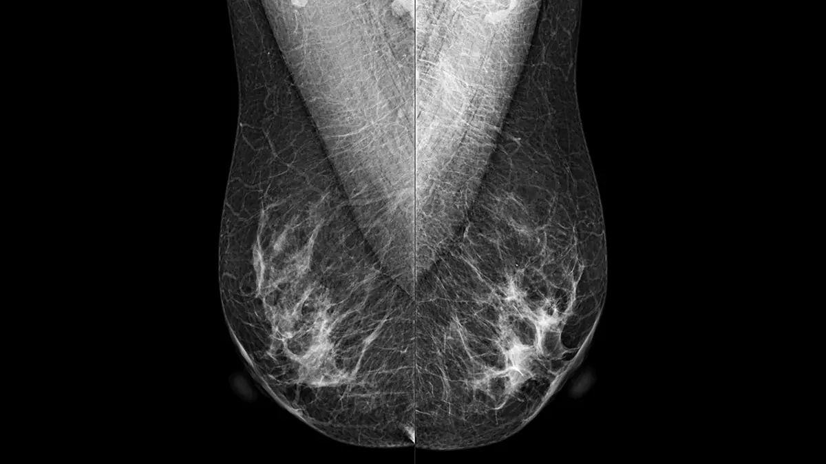 Automatización completa
