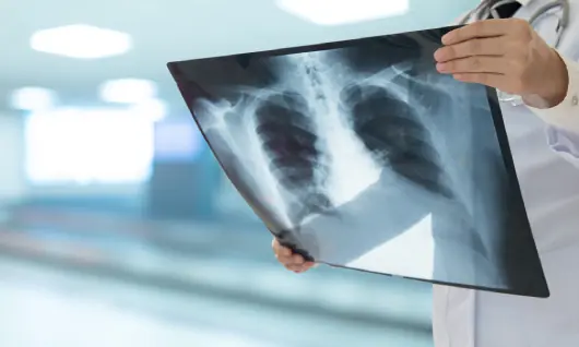 Radiografía de tórax