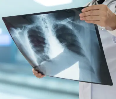 Radiografía de tórax