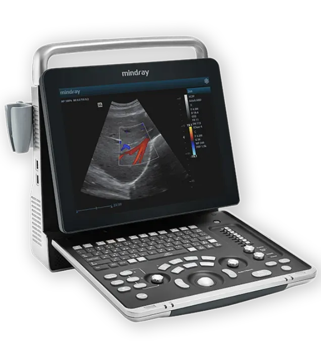 Ecógrafo Portátil Z60 - Promedco