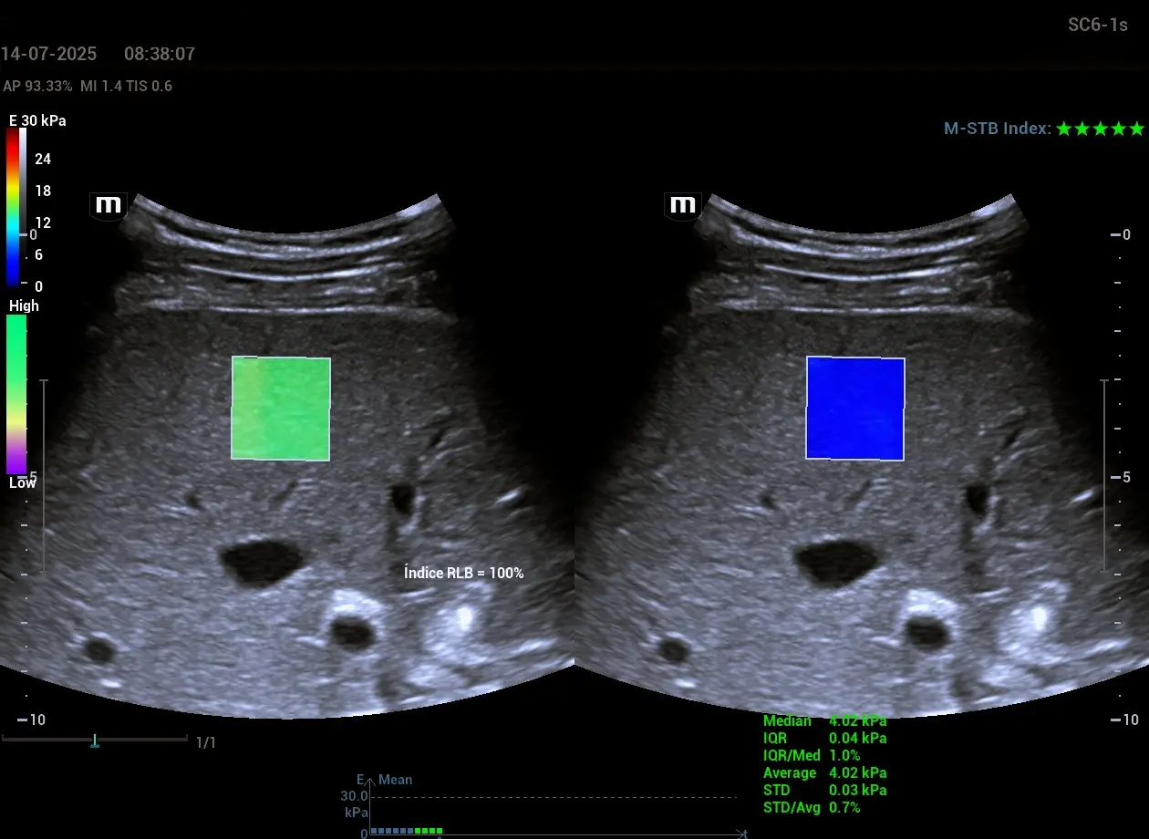 Ergonomía y facilidad de uso para especialistas
