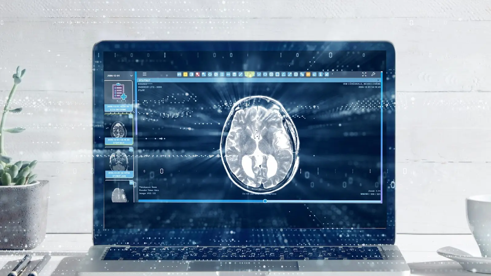 Beneficios para el equipo médico