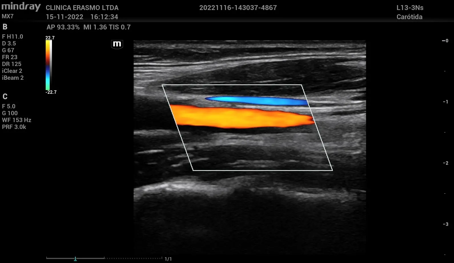 Impacto del Doppler en la toma de decisiones clínicas