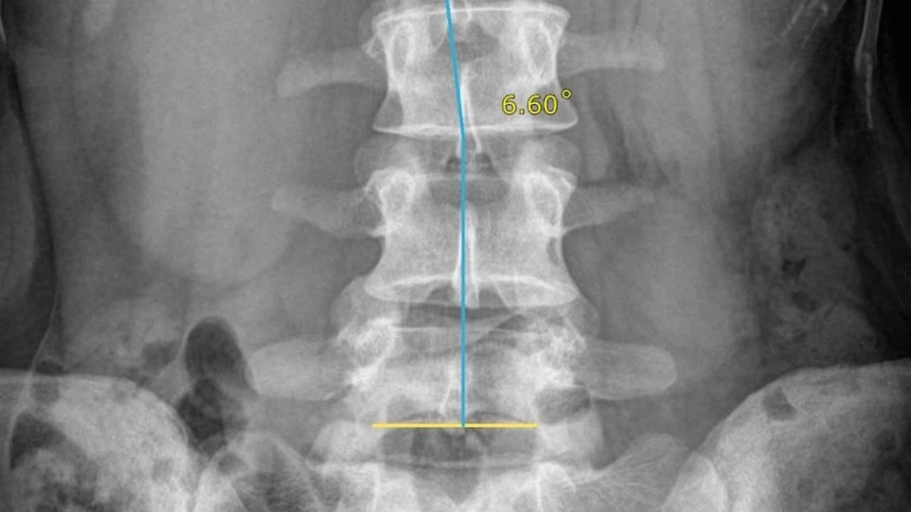 Beneficios operativos de la IA en radiología