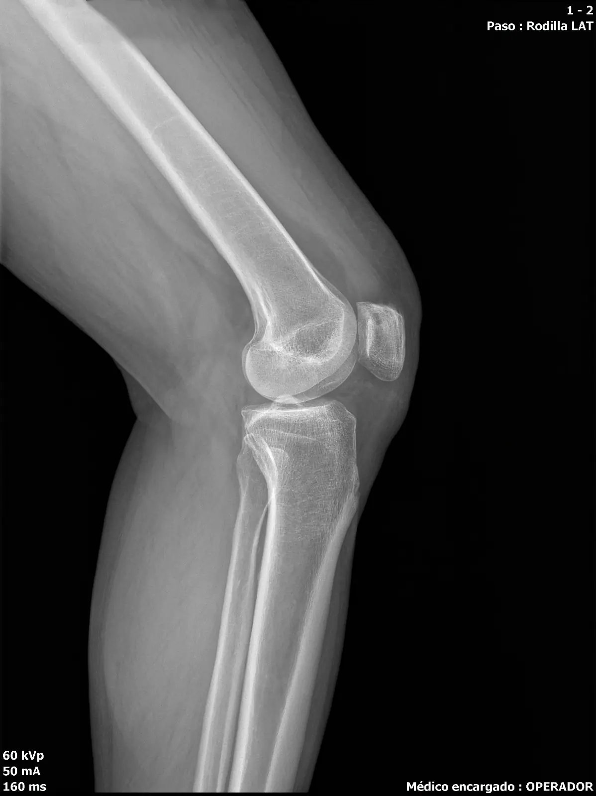 Tendencias en lectura automatizada de rayos X