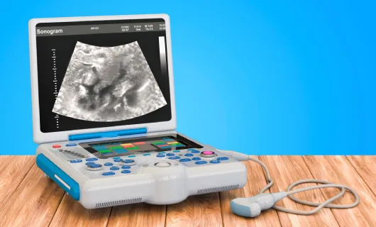 Ecógrafos móviles transformando el ultrasonido en urgencias