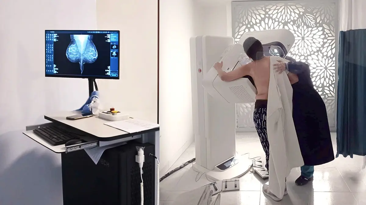 Beneficios cl&iacute;nicos de mejorar el detalle en estructuras peque&ntilde;as