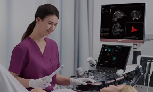 Ultrasonido obstétrico y ginecológico: así es el nuevo Nuewa I10 de Mindray