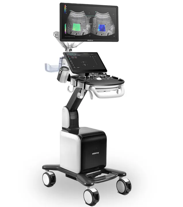 Vista general del equipo de ultrasonido Consona N8, diseñado para ofrecer versatilidad y rendimiento diagnóstico en diferentes entornos hospitalarios.