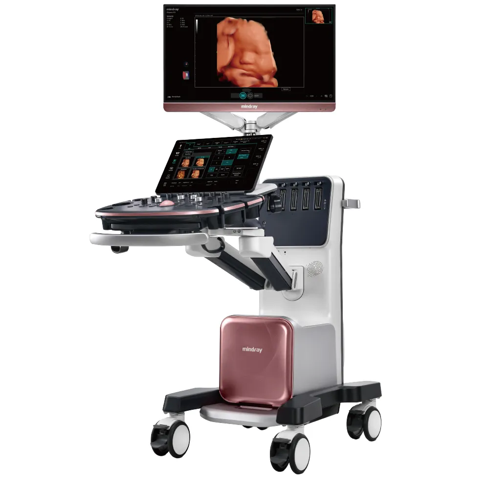 Vista general del sistema de ultrasonido avanzado Nuewa I10 de Mindray con pantalla principal y consola