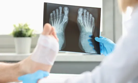 Precisión diagnóstica en fracturas complejas