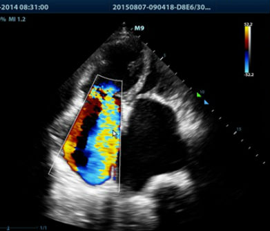 El ecocardiógrafo es un equipo de avanzada tecnología que facilita la obtención de imágenes detalladas del corazón.
