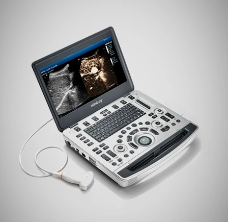 promedco Equipos de Ultrasonido Portátil