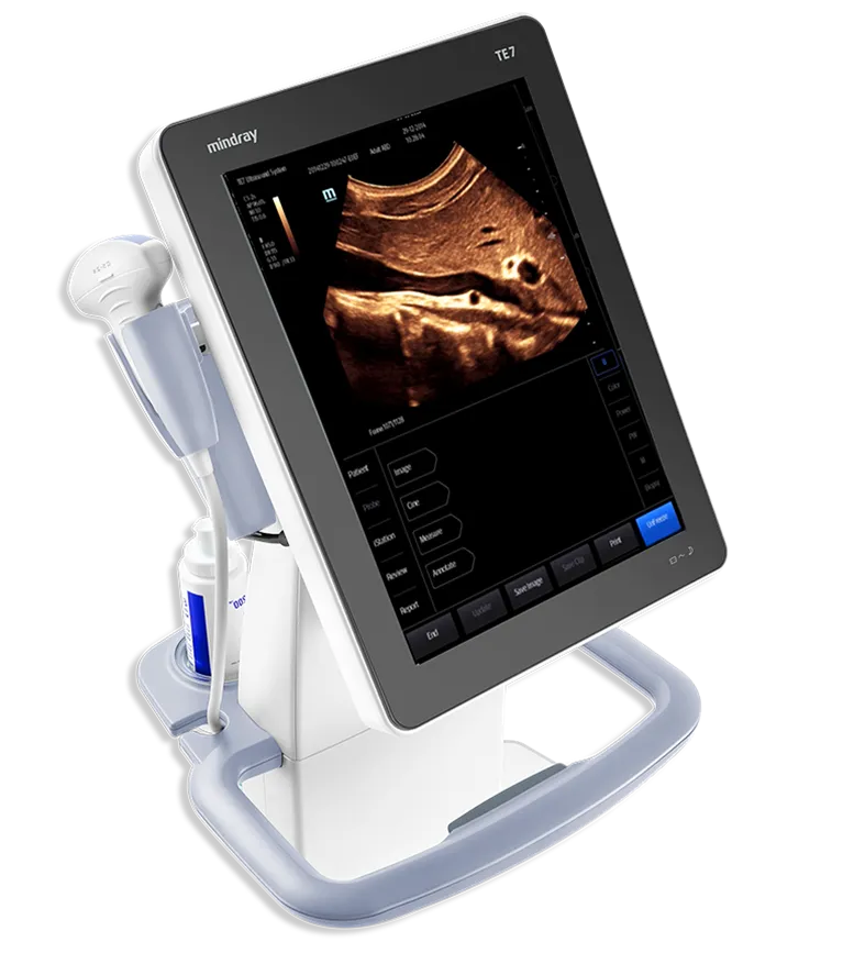 Ultrasonido Ecográfo TE7 | Promedco 